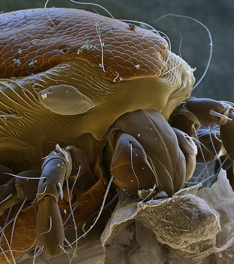 Picture 27 of Marvel at 35 familiar images that become incredibly bizarre under a microscope