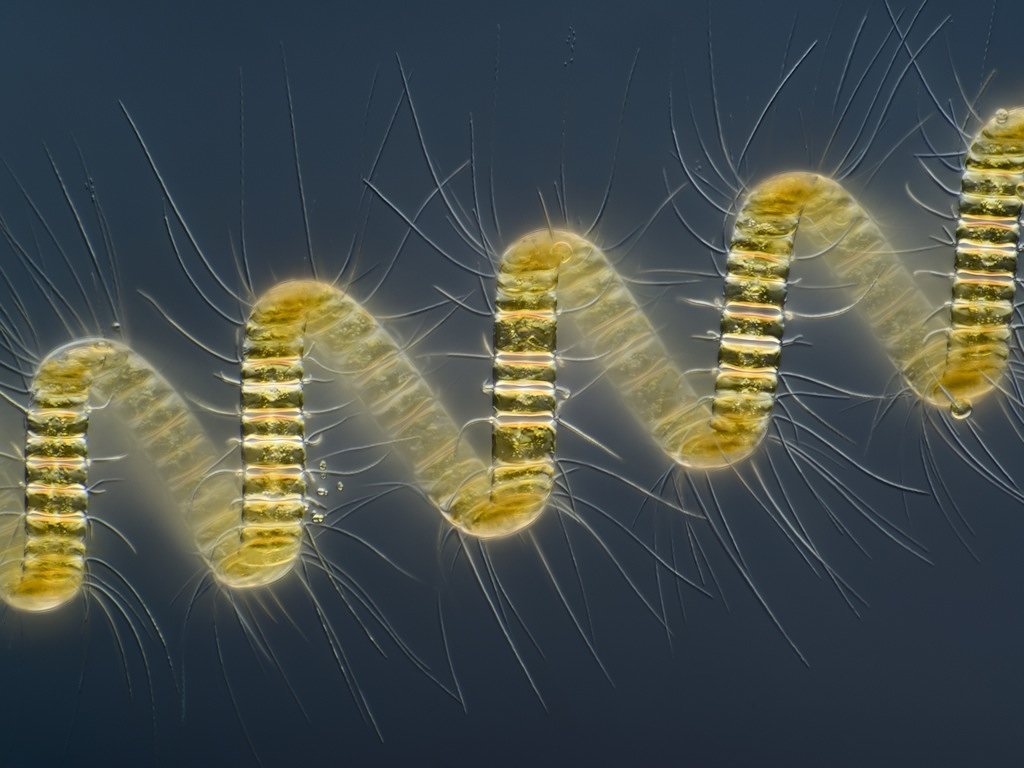 Picture 33 of Marvel at 35 familiar images that become incredibly bizarre under a microscope
