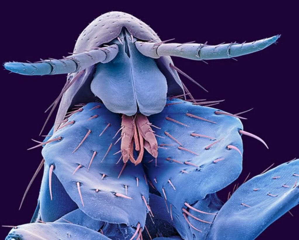 Picture 34 of Marvel at 35 familiar images that become incredibly bizarre under a microscope