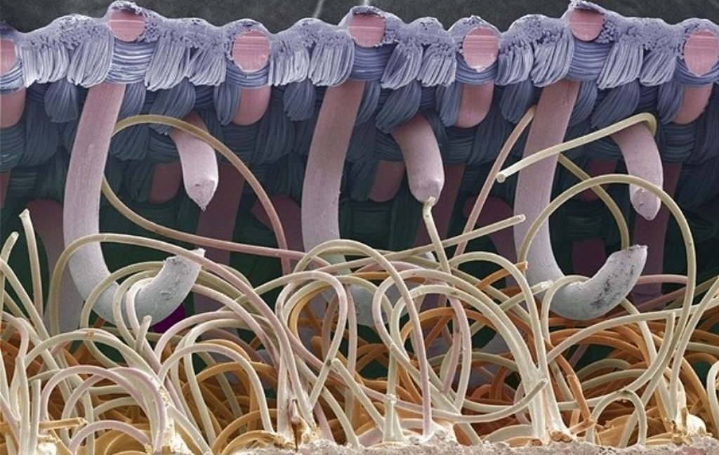 Picture 4 of Marvel at 35 familiar images that become incredibly bizarre under a microscope