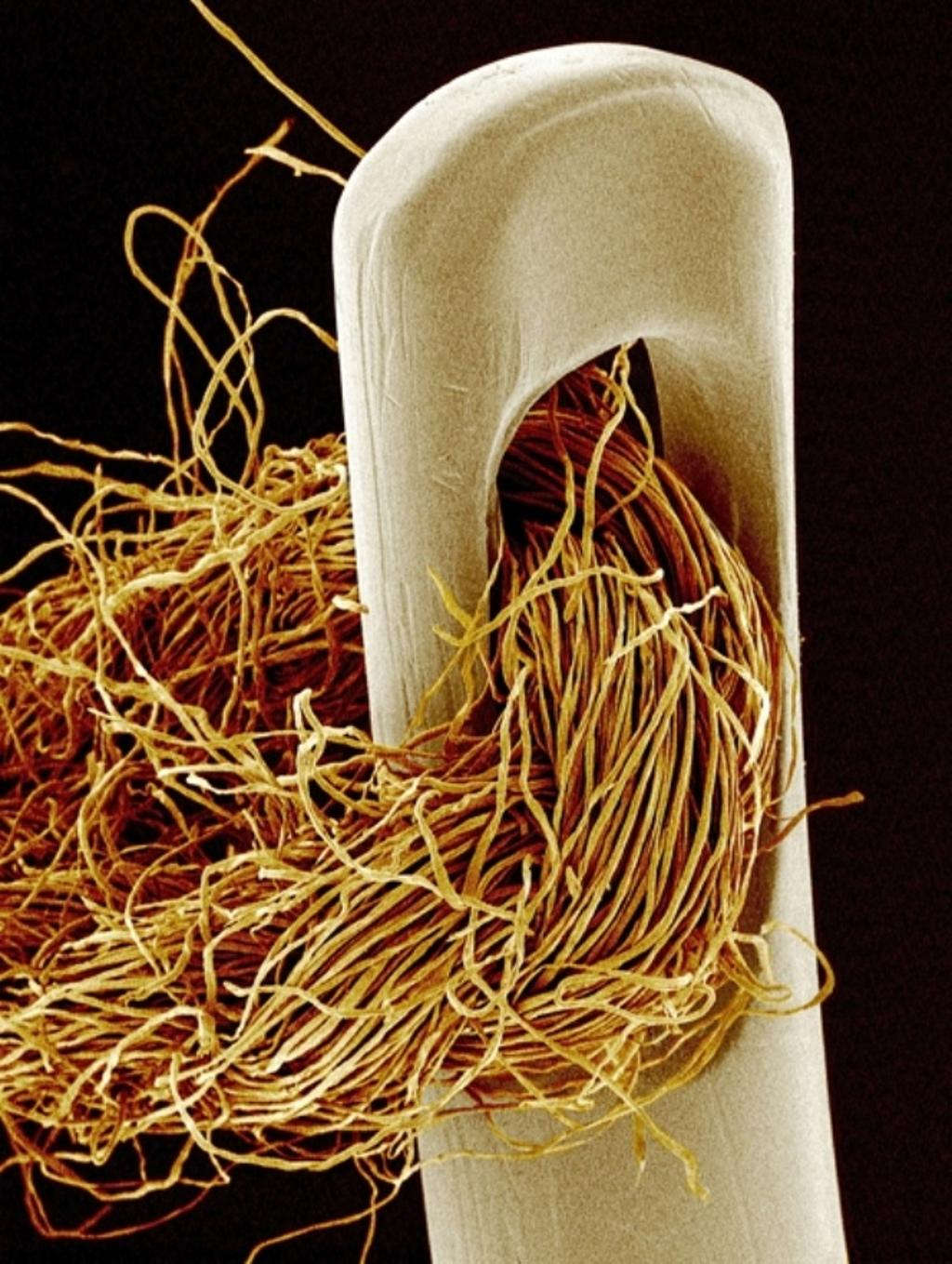 Picture 9 of Marvel at 35 familiar images that become incredibly bizarre under a microscope