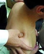 Picture 1 of Massage for pain around the shoulder joint