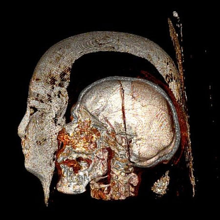 Picture 2 of Medical examination for mummies