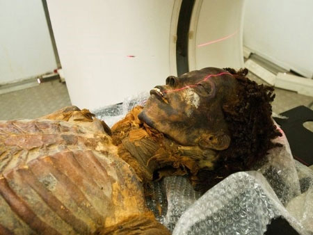 Picture 6 of Medical examination for mummies