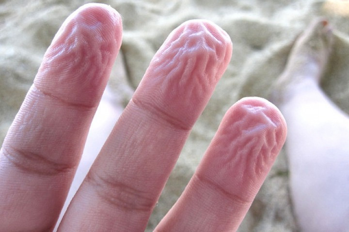 Picture 5 of Meet these phenomena often but not everyone knows the cause