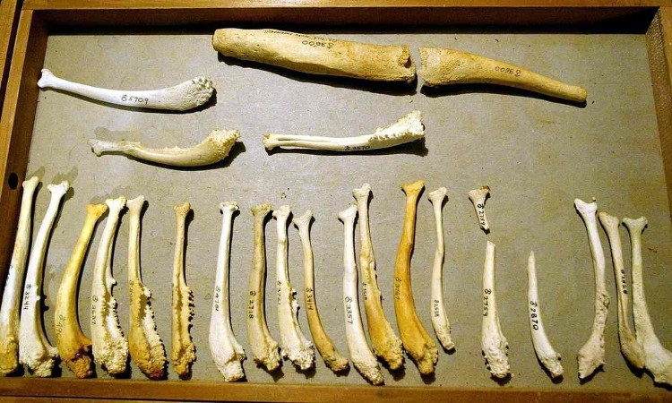 Picture 2 of Men used to have bones at that place but because they were faithful, they were no longer there