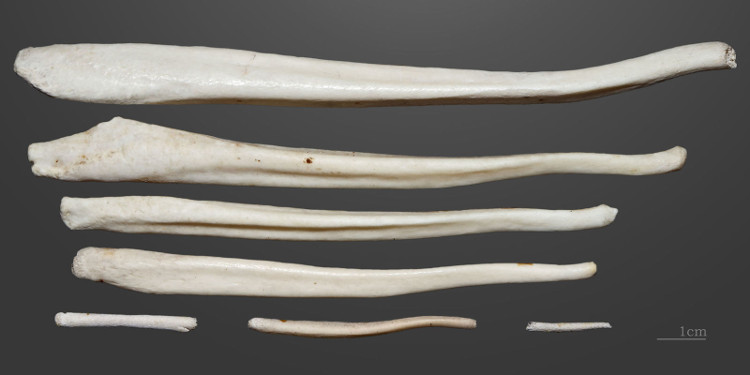 Picture 3 of Men used to have bones at that place but because they were faithful, they were no longer there