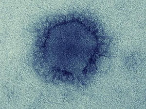 Picture 1 of MERS virus has been transmitted from animals to humans