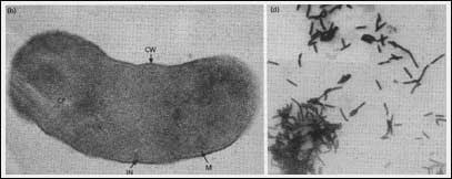 Picture 2 of Methanobacterium - Gas source in the bottom of the water