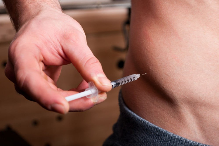 Picture 1 of Method to expose athletes' doping tricks