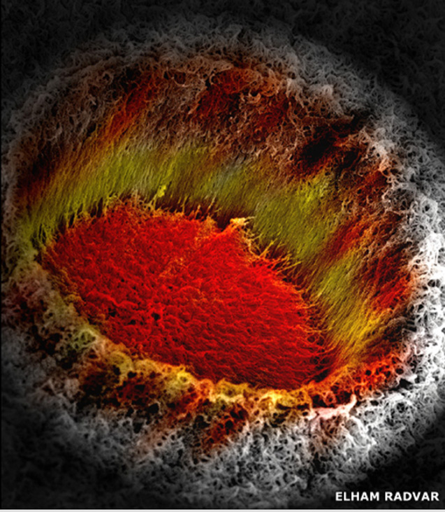 Picture 3 of Microbiology world through microscopy