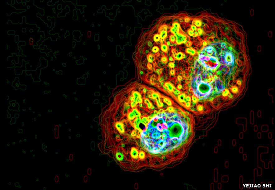 Picture 4 of Microbiology world through microscopy