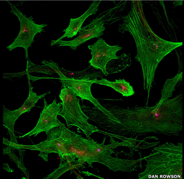 Picture 7 of Microbiology world through microscopy