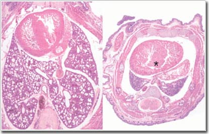 MicroRNA enhances cancer treatment images 3