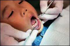 Picture 1 of Milk tooth decay in young children