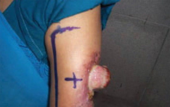 Picture 4 of 'Millions of people suffer' like Wanbi Tuan Anh in the world