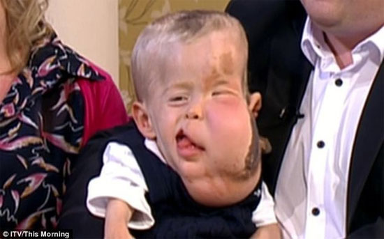 Picture 7 of 'Millions of people suffer' like Wanbi Tuan Anh in the world