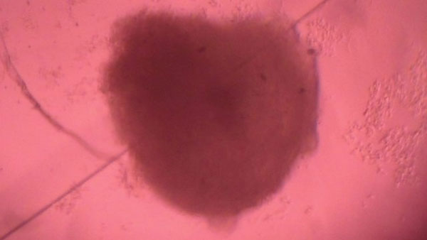 Picture 1 of Mini heart culture for effective cardiovascular treatment