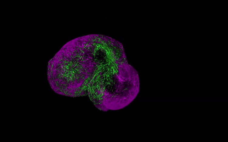 Picture 1 of Mini human brain culture to test hallucinogens