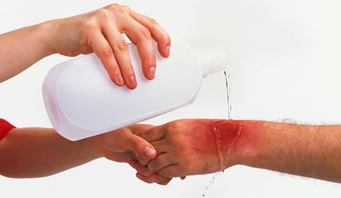 Picture 1 of Mistakes to avoid when first aid victims of acidosis