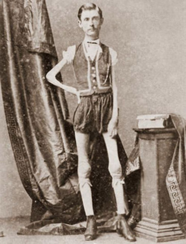 Picture 4 of Mobile circuses and the 9 most exotic characters in history
