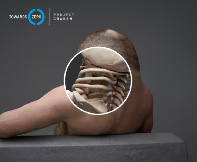 Picture 6 of Model of people who can survive in traffic accidents
