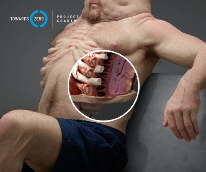 Picture 8 of Model of people who can survive in traffic accidents