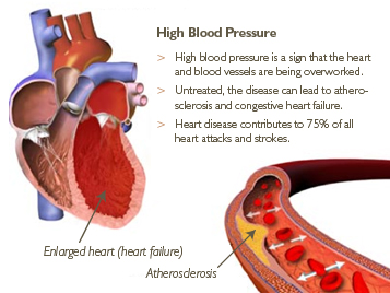 Picture 1 of Molecular control of blood pressure