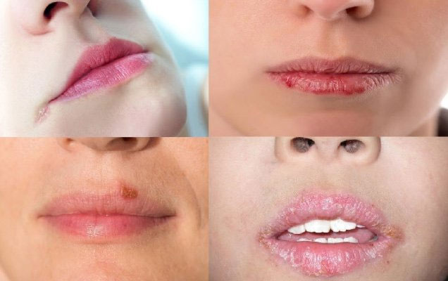 Moment: Causes, symptoms and treatment images 1
