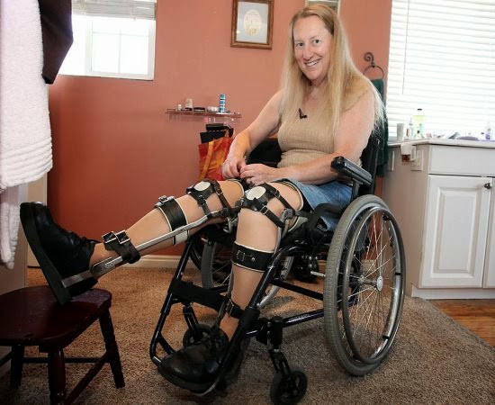 Picture 1 of Monstrous disease of those who want to remove their limbs