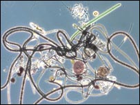 Picture 1 of More than 20,000 types of bacteria in a liter of seawater!