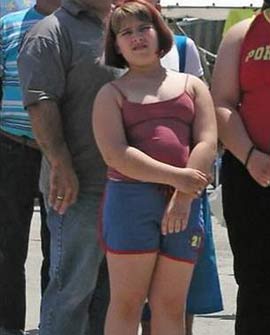 Picture 1 of More than a billion obese people in the world