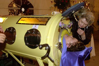 Picture 2 of More than half a century living with artificial lungs