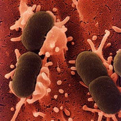 Picture 1 of Mothers are more likely to die from E. coli infection
