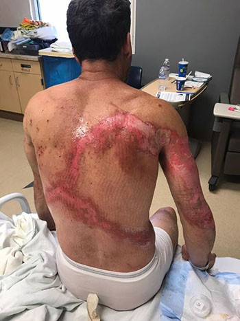Picture 2 of My father and father survived miraculously after being struck by lightning
