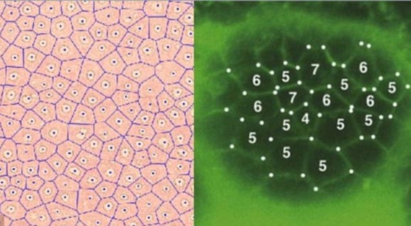 Picture 2 of Mysterious circle between desert like human skin cells?