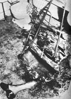 Picture 1 of Mysterious phenomenon of the body burns itself