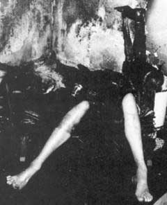 Picture 2 of Mysterious phenomenon of the body burns itself