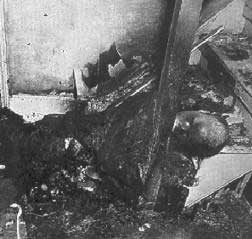 Picture 3 of Mysterious phenomenon of the body burns itself