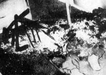 Picture 4 of Mysterious phenomenon of the body burns itself