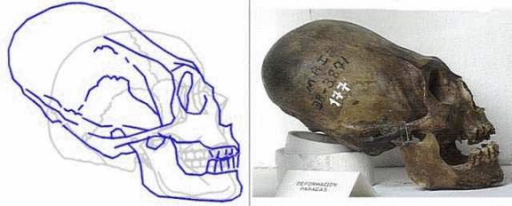 Picture 1 of Mysterious strange human skulls