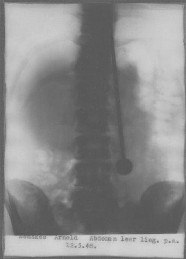 Picture 9 of Mysteriously the man who had cum pierced through his chest 500 times without dying