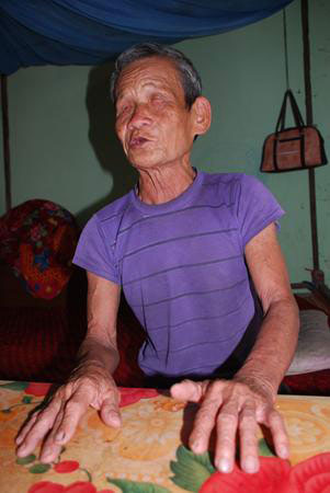 Picture 1 of Mystical hemostasis of Nung people