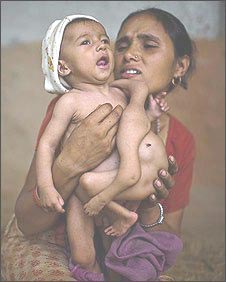 Picture 4 of Nepal tumbles because the baby has 8 limbs
