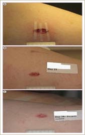 Picture 1 of New artificial skin