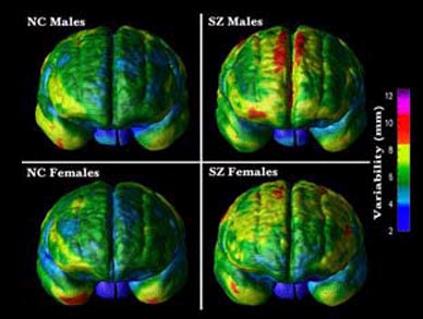 Picture 1 of New breakthrough in treatment of schizophrenia