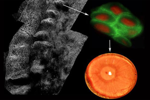 Picture 1 of New breakthroughs help blind people see their eyes