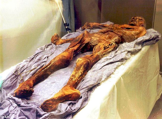 Picture 3 of New cause of the death of the Otzi gang