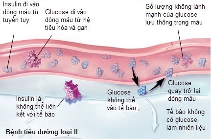 Picture 3 of New diets can save millions of people with type 2 diabetes