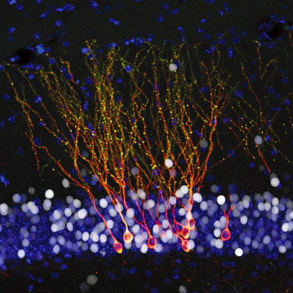 Picture 1 of New discoveries about ancient viruses help better understand HIV